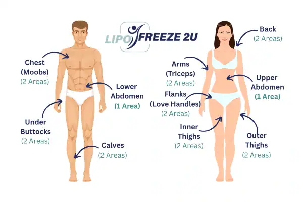 Areas you can have fat freezing treatment Dorset