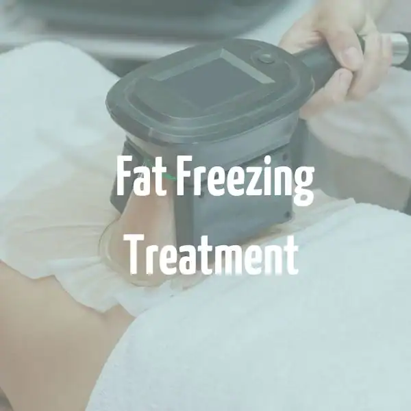 fat freezing treatment Dorset