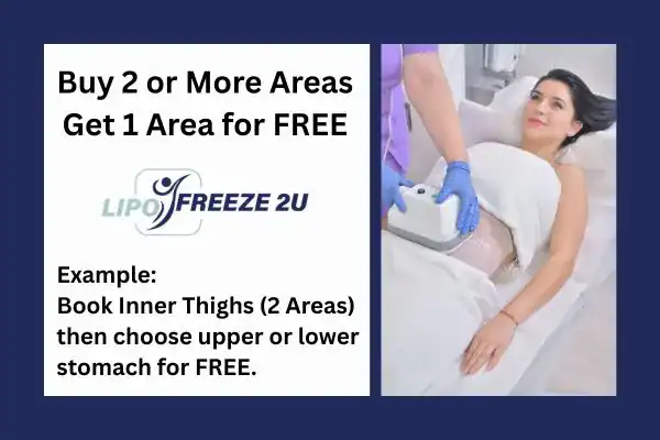 fat freezing prices Dorset