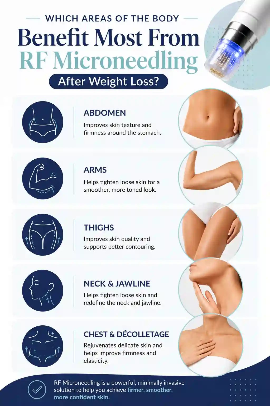 Which Areas of the Body Benefit Most From RF Microneedling After Weight Loss Dorset